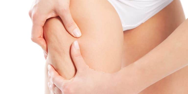 Adiós celulitis: Descubre el plan revolucionario para una piel firme sin salir de casa