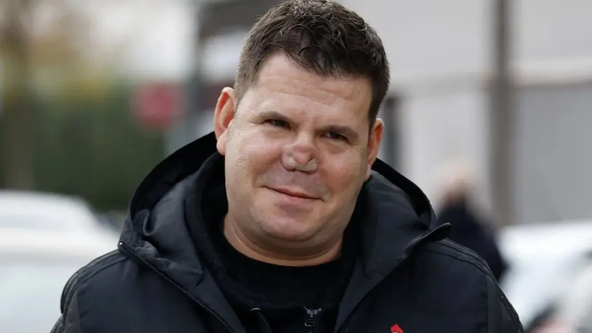 Lucas González cuenta cómo se desarrolla la recuperación su nariz: "Estoy desesperado" Lucas González tremendamente afectado por su problema en la nariz - Fuente: Agencias