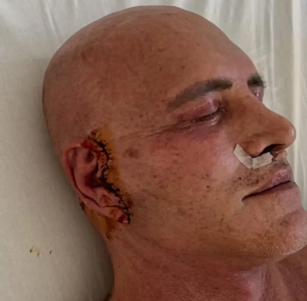 La nueva cara de Kiko Matamoros tras pasar por quirófano dejará en shock a toda España La nueva cara de Kiko Matamoros tras pasar por quirófano dejará en shock a toda España